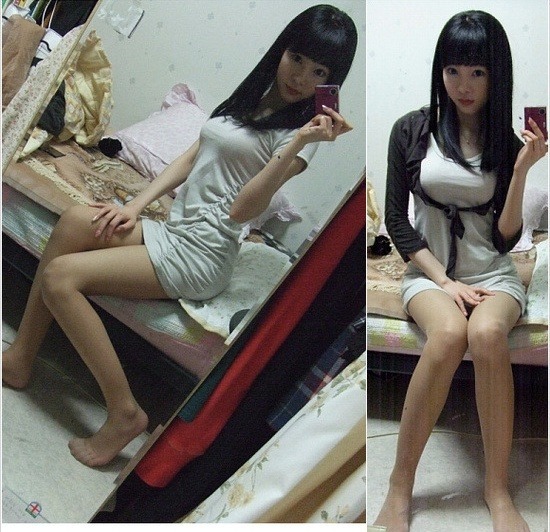 교정이 꼭 필요한 친구 : 6523192507.jpg